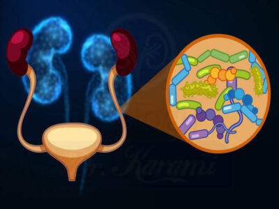 قرص کرنبری شاری 30 عددی