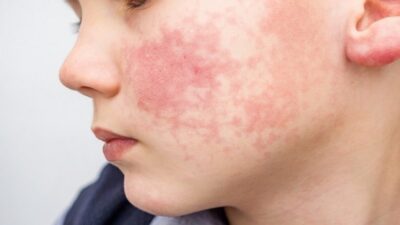 صابون کالندولای گلیسیرینه گیاهی گلمر