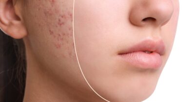 صابون کالاندولا دیترون 30 درصد