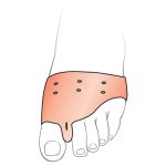 محافظ سینه پا با پد فاصله دهنده انگشت شست OTESSY کد TM35