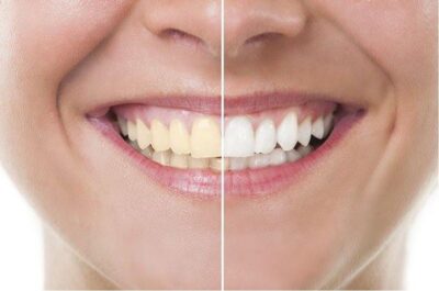 مسواک تریزا مدل فلکسیبل برس متوسط محافظ دار 
