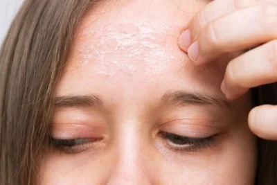 ضد آفتاب بیرنگ +SPF50 پوست نرمال تا خشک درماگور